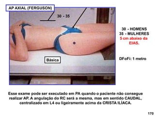 170
AP AXIAL (FERGUSON)
DFoFi: 1 metro
30 - 35
30 - HOMENS
35 - MULHERES
5 cm abaixo da
EIAS.
Esse exame pode ser executado em PA quando o paciente não consegue
realizar AP. A angulação do RC será a mesma, mas em sentido CAUDAL,
centralizado em L4 ou ligeiramente acima da CRISTA ILÍACA.
Básica
 