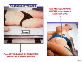 171
Para ARTICULAÇÃO SI ESQUERDA,
executa-se o exame em OPD.
Para ARTICULAÇÃO SI
DIREITA, executa-se o
exame em OPE.
OBLÍQUAS POSTERIORES
Básica
 