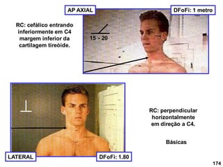 174
RC: cefálico entrando
inferiormente em C4
margem inferior da
cartilagem tireóide.
AP AXIAL DFoFi: 1 metro
LATERAL
RC: perpendicular
horizontalmente
em direção a C4.
DFoFi: 1.80
15 - 20
Básicas
 