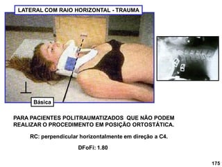 175
LATERAL COM RAIO HORIZONTAL - TRAUMA
PARA PACIENTES POLITRAUMATIZADOS QUE NÃO PODEM
REALIZAR O PROCEDIMENTO EM POSIÇÃO ORTOSTÁTICA.
DFoFi: 1.80
RC: perpendicular horizontalmente em direção a C4.
Básica
 