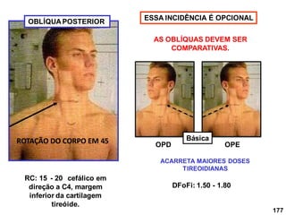 177
OBLÍQUA POSTERIOR
OPD OPE
AS OBLÍQUAS DEVEM SER
COMPARATIVAS.
RC: 15 - 20 cefálico em
direção a C4, margem
inferior da cartilagem
tireóide.
ACARRETA MAIORES DOSES
TIREOIDIANAS
DFoFi: 1.50 - 1.80
ESSA INCIDÊNCIA É OPCIONAL
ROTAÇÃO DO CORPO EM 45 Básica
 