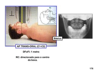 AP TRANS-ORAL (C1-C2)
DFoFi: 1 metro
RC: direcionado para o centro
da boca.
178
Básica
 