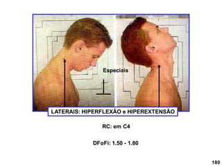 180
LATERAIS: HIPERFLEXÃO e HIPEREXTENSÃO
RC: em C4
DFoFi: 1.50 - 1.80
Especiais
 