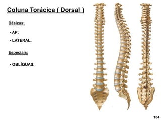 184
Coluna Torácica ( Dorsal )
Básicas:
• AP;
• LATERAL.
Especiais:
• OBLÍQUAS.
 