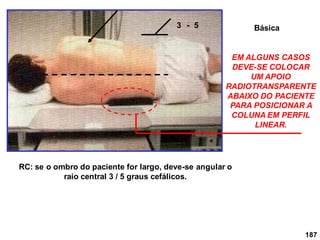 187
3 - 5
RC: se o ombro do paciente for largo, deve-se angular o
raio central 3 / 5 graus cefálicos.
EM ALGUNS CASOS
DEVE-SE COLOCAR
UM APOIO
RADIOTRANSPARENTE
ABAIXO DO PACIENTE
PARA POSICIONAR A
COLUNA EM PERFIL
LINEAR.
Básica
 