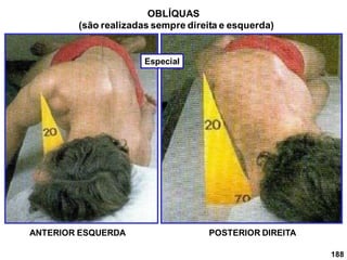 188
OBLÍQUAS
(são realizadas sempre direita e esquerda)
ANTERIOR ESQUERDA POSTERIOR DIREITA
Especial
 