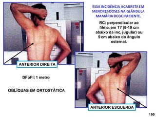 190
OBLÍQUAS EM ORTOSTÁTICA
ESSA INCIDÊNCIA ACARRETAEM
MENORESDOSES NA GLÂNDULA
MAMÁRIADO(A) PACIENTE.
RC: perpendicular ao
filme, em T7 (8-10 cm
abaixo da inc. jugular) ou
5 cm abaixo do ângulo
esternal.
DFoFi: 1 metro
ANTERIOR ESQUERDA
ANTERIOR DIREITA
 