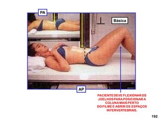 192
AP
PA
PACIENTEDEVE FLEXIONAROS
JOELHOSPARAPOSICIONAR A
COLUNAMAIS PERTO
DO FILME E ABRIR OS ESPAÇOS
INTERVERTEBRAIS.
Básica
 
