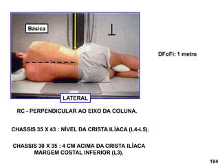 194
LATERAL
DFoFi: 1 metro
RC - PERPENDICULAR AO EIXO DA COLUNA.
CHASSIS 35 X 43 : NÍVEL DA CRISTA ILÍACA (L4-L5).
CHASSIS 30 X 35 : 4 CM ACIMA DA CRISTA ILÍACA
MARGEM COSTAL INFERIOR (L3).
Básica
 