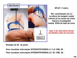 196
OBLÍQUAS
DFoFi: 1 metro
Rotação de 45 da parte.
RC: centralizado em L3
na altura da margem costal
inferior (4 cm acima da crista
Ilíaca) e 2 polegadas
medial EIAS do lado de cima.
OBS: O RC NÃO DEVE ESTAR
NA MESMA LINHA DA COLUNA.
Para visualizar articulação INTERAPOFISÁRIA L1 / L5: OBL 50 .
Para visualizar articulação INTERAPOFISÁRIA L5 / S1: OBL 30 .
Básica
 