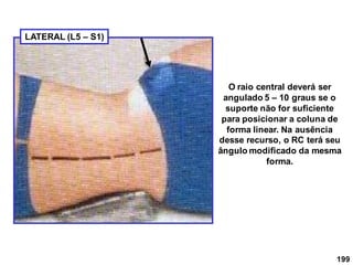 199
O raio central deverá ser
angulado 5 – 10 graus se o
suporte não for suficiente
para posicionar a coluna de
forma linear. Na ausência
desse recurso, o RC terá seu
ângulo modificado da mesma
forma.
LATERAL (L5 – S1)
 