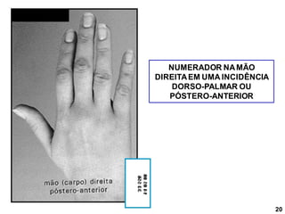 NUMERADOR NAMÃO
DIREITAEM UMA INCIDÊNCIA
DORSO-PALMAR OU
PÓSTERO-ANTERIOR
20
 