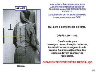203
RC: para o ponto médio do filme.
DFoFi: 1.00 – 1.50.
O suficiente para
conseguir uma colimação uniforme,
incluindo todos os segmentos da
coluna. As áreas adjacentes das
costelas devem aparecer na
radiografia.
Básica
A INCIDÊNCIAPA É PREFERIDA,POIS
ACARRETAEM MENORES DOSESNA
GLÂNDULAMAMÁRIAE TIREÓIDE DO(A)
PACIENTE.
A COLUNAENCONTRA-SE AFASTADADO
FILME,AUMENTANDO ADOF.
AP – PA
O PACIENTE DEVE ESTAR DESCALÇO.
 