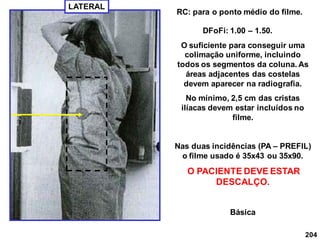 204
RC: para o ponto médio do filme.
LATERAL
DFoFi: 1.00 – 1.50.
O suficiente para conseguir uma
colimação uniforme, incluindo
todos os segmentos da coluna. As
áreas adjacentes das costelas
devem aparecer na radiografia.
No mínimo, 2,5 cm das cristas
ilíacas devem estar incluídos no
filme.
Nas duas incidências (PA – PREFIL)
o filme usado é 35x43 ou 35x90.
O PACIENTE DEVE ESTAR
DESCALÇO.
Básica
 