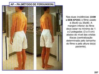 207
Nas duas incidências (COM
e SEM APOIO) o filme usado
é 35x43 ou 35x90. A
margem inferior do filme
deve estar no mínimo de 1
a 2 polegadas (3 a 5 cm)
abaixo do nível das cristas
ilíacas (centralização
determinada pelo tamanho
do filme e pela altura do(a)
paciente).
AP – PA (MÉTODO DE FERGUNSON)
 