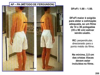 208
DFoFi: 1.00 – 1.50.
DFoFi maior é exigida
para obter a colimação
adequada, se um filme
de 14 x 36 polegadas
(35 x 90 cm) estiver
sendo usado.
RC: perpendicular,
direcionado para o
ponto médio do filme.
No mínimo, 2,5 cm
das cristas ilíacas
devem estar
incluídos no filme.
AP – PA (MÉTODO DE FERGUNSON)
 