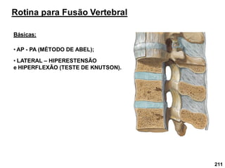 211
Rotina para Fusão Vertebral
Básicas:
• AP - PA (MÉTODO DE ABEL);
• LATERAL – HIPERESTENSÃO
e HIPERFLEXÃO (TESTE DE KNUTSON).
 