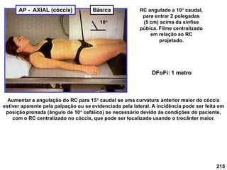 215
RC angulado a 10 caudal,
para entrar 2 polegadas
(5 cm) acima da sínfise
púbica. Filme centralizado
em relação ao RC
projetado.
AP - AXIAL (cóccix)
DFoFi: 1 metro
Aumentar a angulação do RC para 15 caudal se uma curvatura anterior maior do cóccix
estiver aparente pela palpação ou se evidenciada pela lateral. A incidência pode ser feita em
posição pronada (ângulo de 10 cefálico) se necessário devido às condições do paciente,
com o RC centralizado no cóccix, que pode ser localizado usando o trocânter maior.
10
Básica
 