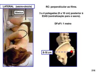 216
LATERAL (sacro-cóccix) RC: perpendicular ao filme.
3 a 4 polegadas (8 a 10 cm) posterior à
ElAS (centralização para o sacro).
8-10 cm
DFoFi: 1 metro
Básica
 