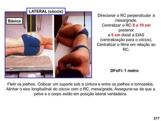 217
LATERAL (cóccix)
Direcionar o RC perpendicular à
mesa/grade.
Centralizar o RC 8 a 10 cm
posterior
e 5 cm distal à ElAS
(centralização para o cóccix).
Centralizar o filme em relação ao
RC.
DFoFi: 1 metro
Fletir os joelhos. Colocar um suporte sob a cintura e entre os joelhos e tornozelos.
Alinhar o eixo longitudinal do cóccix com o RC, mesa/grade. Assegurar-se de que a
pelve e o corpo estão em posição lateral verdadeira.
Básica
 