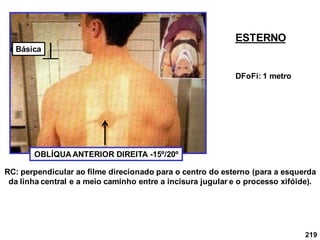 219
OBLÍQUA ANTERIOR DIREITA -15º/20º
RC: perpendicular ao filme direcionado para o centro do esterno (para a esquerda
da linha central e a meio caminho entre a incisura jugular e o processo xifóide).
DFoFi: 1 metro
ESTERNO
Básica
 