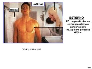 220
ESTERNO
LATERAL
RC: perpendicular, no
centro do esterno a
caminho entre
inc.jugular e processo
xifóide.
DFoFi: 1.50 – 1.80
Básica
 