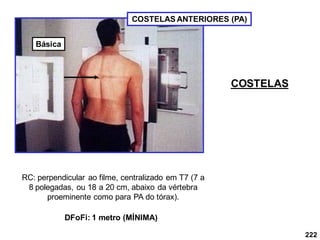 222
COSTELAS ANTERIORES (PA)
RC: perpendicular ao filme, centralizado em T7 (7 a
8 polegadas, ou 18 a 20 cm, abaixo da vértebra
proeminente como para PA do tórax).
DFoFi: 1 metro (MÍNIMA)
COSTELAS
Básica
 