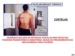 224
PA DO ARCABOUÇO TORÁCICO
COSTELAS
INCIDÊNCIA INCLUÍDA NA ROTINA DE COSTELAS PARA DETECTAR
POSSÍVEIS PNUEMOTÓRAX E HEMOTÓRAX. SEGUE OS PROCEDIMENTOS DE
UMA INCIDÊNCIA PARA PULMÕES.
Básica
 