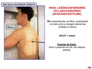 226
OBLÍQUA ANTERIOR DIREITA
RC: perpendicular ao filme, centralizado
no meio entre a margem lateral das
costelas e coluna.
DFoFi: 1 metro
PARA LESÕESANTERIORES
DO LADO ESQUERDO
(AFASTADO DO FILME).
Posição da Parte:
Girar o paciente em 45 em oblíqua
anterior.
Básica
 