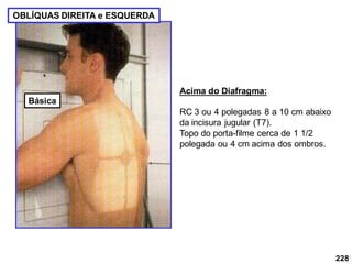 228
OBLÍQUAS DIREITA e ESQUERDA
Acima do Diafragma:
RC 3 ou 4 polegadas 8 a 10 cm abaixo
da incisura jugular (T7).
Topo do porta-filme cerca de 1 1/2
polegada ou 4 cm acima dos ombros.
Básica
 
