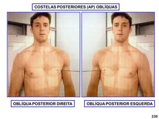 COSTELAS POSTERIORES (AP) OBLÍQUAS
OBLÍQUA POSTERIOR DIREITA OBLÍQUA POSTERIOR ESQUERDA
230
 
