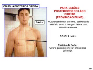 231
PARA LESÕES
POSTERIORES DO LADO
DIREITO
(PRÓXIMOAO FILME).
RC: perpendicular ao filme, centralizado
no meio entre a margem lateral das
costelas e coluna.
DFoFi: 1 metro
OBLÍQUA POSTERIOR DIREITA
Posição da Parte:
Girar o paciente em 45 em oblíqua
posterior.
Básica
 