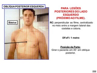 232
PARA LESÕES
POSTERIORES DO LADO
ESQUERDO
(PRÓXIMOAO FILME).
RC: perpendicular ao filme, centralizado
no meio entre a margem lateral das
costelas e coluna.
DFoFi: 1 metro
OBLÍQUA POSTERIOR ESQUERDA
Posição da Parte:
Girar o paciente em 45 em oblíqua
posterior.
Básica
 