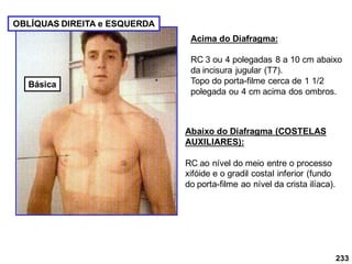 233
Acima do Diafragma:
RC 3 ou 4 polegadas 8 a 10 cm abaixo
da incisura jugular (T7).
Topo do porta-filme cerca de 1 1/2
polegada ou 4 cm acima dos ombros.
OBLÍQUAS DIREITA e ESQUERDA
Abaixo do Diafragma (COSTELAS
AUXILIARES):
RC ao nível do meio entre o processo
xifóide e o gradil costaI inferior (fundo
do porta-filme ao nível da crista ilíaca).
Básica
 