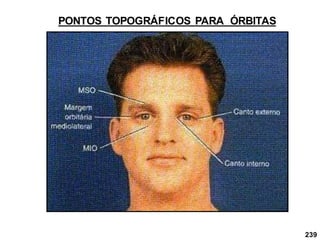PONTOS TOPOGRÁFICOS PARA ÓRBITAS
239
 
