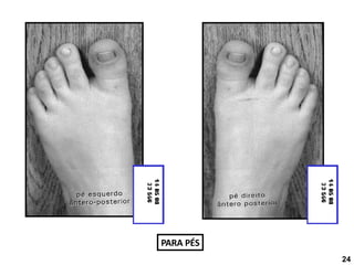 PARA PÉS
24
 