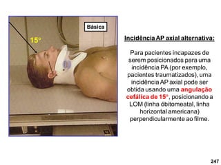 247
IncidênciaAP axial alternativa:
Para pacientes incapazes de
serem posicionados para uma
incidência PA (por exemplo,
pacientes traumatizados), uma
incidênciaAP axial pode ser
obtida usando uma angulação
cefálica de 15, posicionando a
LOM (linha óbitomeatal, linha
horizontal americana)
perpendicularmente ao filme.
15
Básica
 