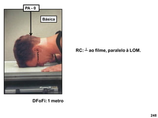 248
DFoFi:1 metro
RC: ┴ ao filme, paralelo à LOM.
PA - 0
Básica
 