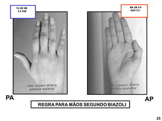 AP
REGRA PARA MÃOS SEGUNDO BIAZOLI
PA
25
 