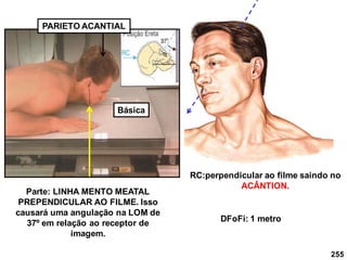 255
Parte: LINHA MENTO MEATAL
PREPENDICULAR AO FILME. Isso
causará uma angulação na LOM de
37º em relação ao receptor de
imagem.
RC:perpendicular ao filme saindo no
ACÂNTION.
DFoFi: 1 metro
PARIETO ACANTIAL
Básica
 