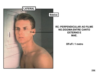 256
LATERAL
RC: PERPENDICULAR AO FILME
NO ZIGOMA ENTRE CANTO
EXTERNO E
MAE.
DFoFi: 1 metro
Básica
 