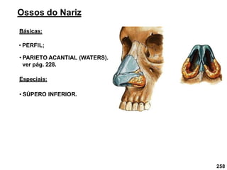 258
Ossos do Nariz
Básicas:
• PERFIL;
• PARIETO ACANTIAL (WATERS).
ver pág. 228.
Especiais:
• SÚPERO INFERIOR.
 