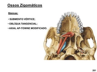 Ossos Zigomáticos
Básicas:
• SUBMENTO VÉRTICE;
• OBLÍQUA TANGENCIAL;
• AXIAL AP-TOWNE MODIFICADO.
261
 