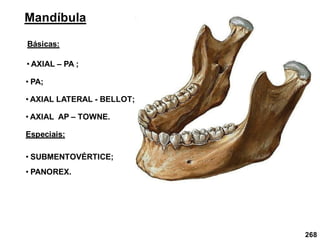 268
Mandíbula
Básicas:
• AXIAL – PA ;
• AXIAL LATERAL - BELLOT;
• AXIAL AP – TOWNE.
Especiais:
• SUBMENTOVÉRTICE;
• PANOREX.
• PA;
 