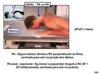 269
AXIAL – PA ou PA
PA - (figura maior):Alinhe o RC perpendicular ao filme,
centrado para sair na junção dos lábios.
PA axial - (opcional - fig.menor a esquerda):Angule o RC 20 /
25cefalicamente, centrado para sair no acântio.
DFoFi 1 metro.
Básica
 