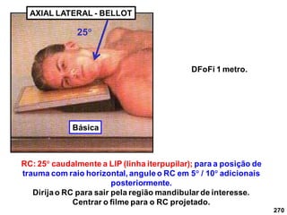 270
AXIAL LATERAL - BELLOT
RC: 25 caudalmente a LlP (linha iterpupilar); para a posição de
trauma com raio horizontal, anguleo RC em 5 / 10 adicionais
posteriormente.
Dirijao RC para sair pela região mandibular de interesse.
Centrar o filme para o RC projetado.
DFoFi 1 metro.
25
Básica
 