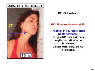 271
AXIAL LATERAL - BELLOT
DFoFi 1 metro.
RC: 25 caudalmente a LlP;
Trauma : 5 / 10 adicionais
posteriormente.
Dirijao RC para sair pela
região mandibular de
interesse.
Centre o filme para o RC
projetado.
25
Básica
 