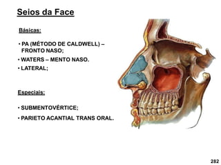282
Seios da Face
Básicas:
• PA (MÉTODO DE CALDWELL) –
FRONTO NASO;
• LATERAL;
• WATERS – MENTO NASO.
Especiais:
• SUBMENTOVÉRTICE;
• PARIETO ACANTIAL TRANS ORAL.
 