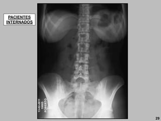 13-02-2011
10005
ROBERTO
PACIENTES
INTERNADOS
29
 