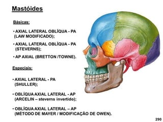 290
Mastóides
Básicas:
• AXIAL LATERAL OBLÍQUA - PA
(LAW MODIFICADO);
• AXIAL LATERAL OBLÍQUA - PA
(STEVERNS);
• AP AXIAL (BRETTON /TOWNE).
Especiais:
• AXIAL LATERAL - PA
(SHULLER);
• OBLÍQUA AXIAL LATERAL - AP
(ARCELIN – steverns invertido);
• OBLÍQUA AXIAL LATERAL – AP
(MÉTODO DE MAYER / MODIFICAÇÃO DE OWEN).
 